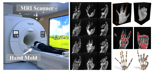 MRI 手部数据采集示意